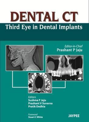 Dental CT Third Eye in Dental Implants