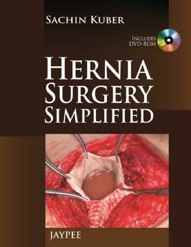 Hernia Surgery Simplified