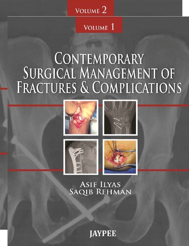 Contemporary Surgical Management of Fractures and Complications