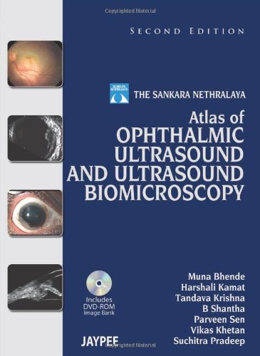 Sankara Nethralaya Atlas of Ophthalmic Ultrasound and Ultrasound Biomicroscopy