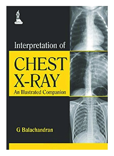 Interpretation of Chest X-Ray