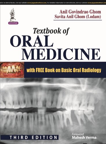 Textbook of Oral Medicine with Free Book on Basic Oral Radiology