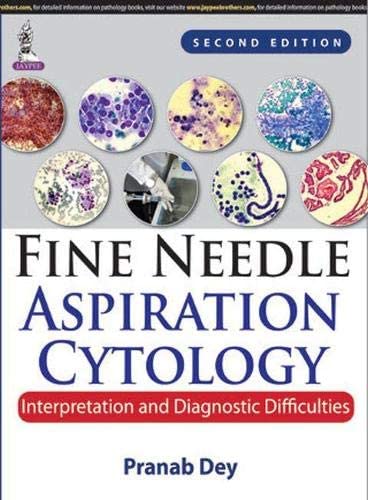 Fine Needle Aspiration Cytology: Interpretation and Diagnostic Difficulties