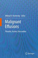 Malignant Effusions Pleuritis, Ascites, Pericardites