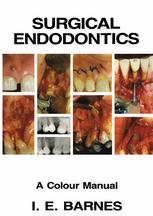 Surgical Endodontics : A Colour Manual.