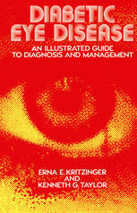 Diabetic Eye Disease : an Illustrated Guide to Diagnosis and Management