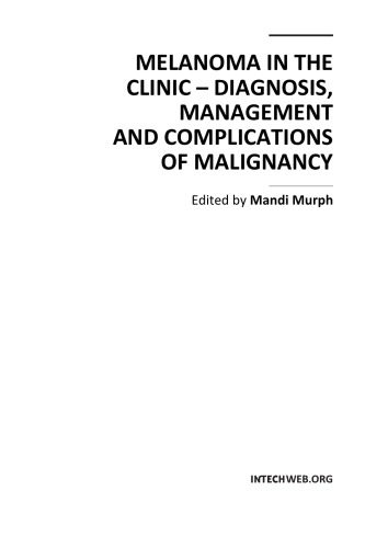 Histopathological Diagnosis of Early Stage of Malignant Melanoma.