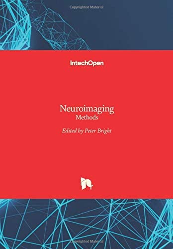 Pediatric Cranial Ultrasound Techniques, Variants and Pitfalls