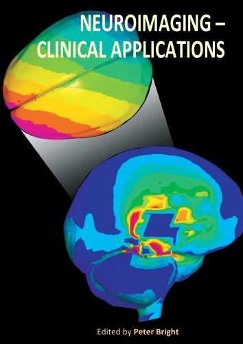 Molecular Imaging of #xF061;7 Nicotinic Acetylcholine Receptors in Vivo Current Status and Perspectives