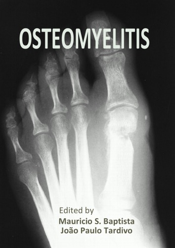 Chronic Non-Bacterial Osteitis