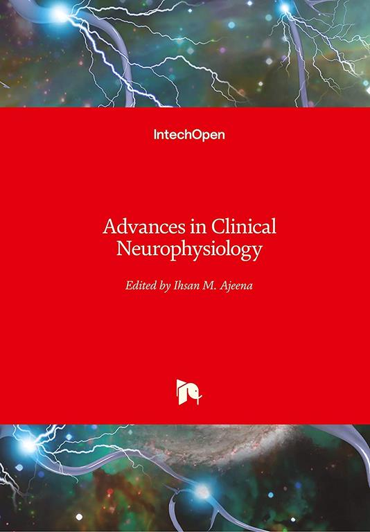 Mild Cognitive Impairment and Quantitative Eeg Markers Degenerative Versus Vascular Brain Damage