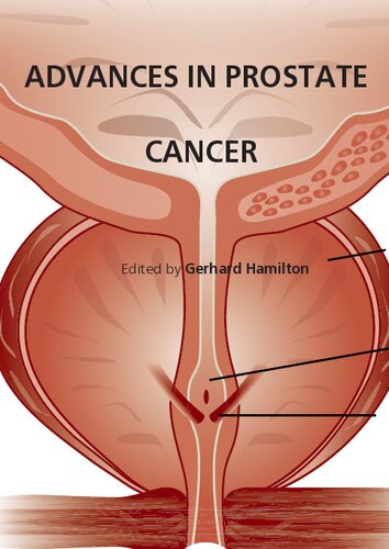 Salinomycin-Induced Apoptosis in Human Prostate Cancer Cells.