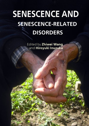 Molecular Mechanisms of Cellular Senescence.