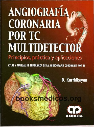 Angiografía Coronaria por Tc – Multidetector – Principios, Práctica y Aplicaciones