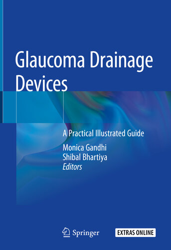 Glaucoma Drainage Devices : A Practical Illustrated Guide