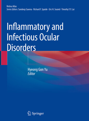 Inflammatory and infectious ocular disorders