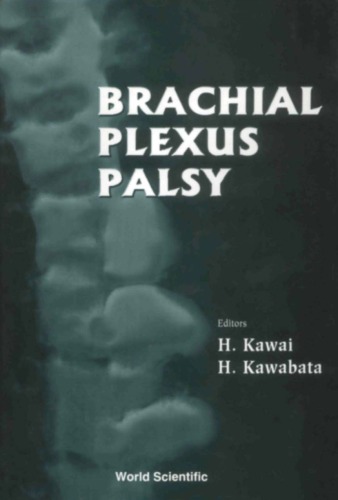 Brachial plexus palsy