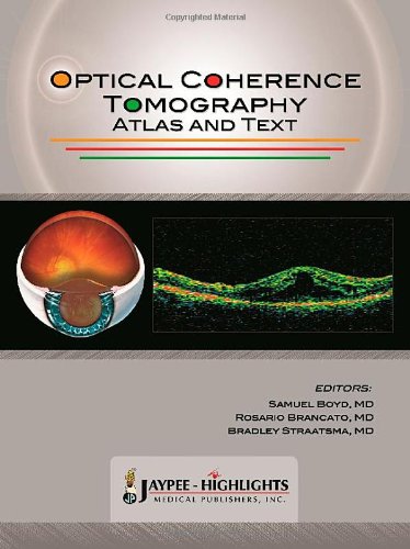 Optical Coherence Tomography