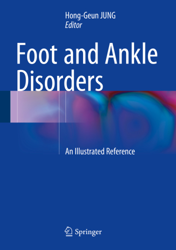 Foot and ankle disorders