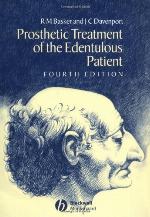 Prosthetic Treatment of the Edentulous Patient