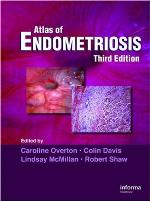 Atlas of Endometriosis