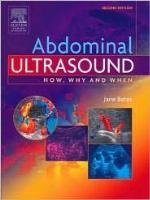 Abdominal Ultrasound