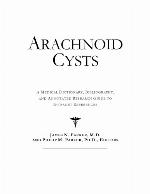 Arachnoid cysts : a medical dictionary, bibliography, and annotated research guide to internet references