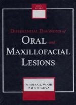 Differential Diagnosis Of Oral And Maxillofacial Lesions