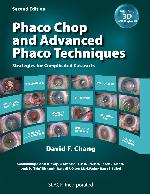 Phaco Chop and Advanced Phaco Techniques