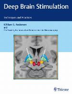 Deep brain stimulation : techniques and practices