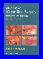 An Atlas of Minor Oral Surgery