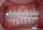 Complete Dental Prosthetics