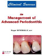 Clinical Success in Management of Advanced Periodontitis