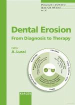 Dental Erosion
