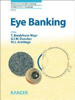 Eye Banking
