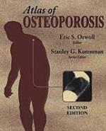 Atlas of Osteoporosis.