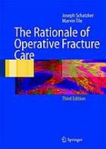 The Rationale of Operative Fracture Care