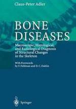 Bone diseases : macroscopic, histological, and radiological diagnosis of structural changes in the skeleton