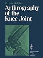 Arthrography of the Knee Joint