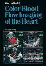 Color Blood Flow Imaging of the Heart