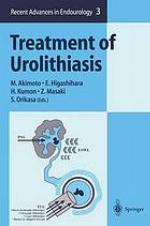Treatment of urolithiasis