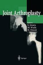 Joint arthroplasty.