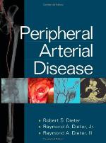 Peripheral Arterial Disease