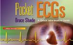 Pocket Ecgs