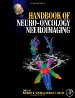 Handbook of Neuro-Oncology Neuroimaging