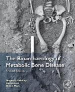 The Bioarchaeology of Metabolic Bone Disease