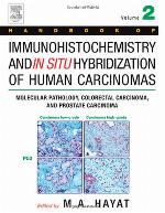 Handbook of Immunohistochemistry and in Situ Hybridization of Human Carcinomas, Volume 2