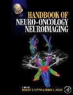 Handbook of Neuro-Oncology Neuroimaging