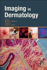 Imaging in dermatology