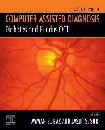 Diabetes and Fundus Oct